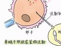 做试管婴儿助孕胚胎移植后应该要注意的事情有哪些？